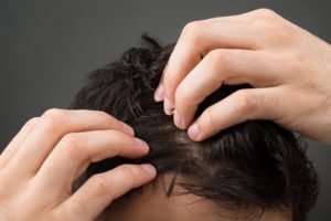 Cropped image of man suffering from hair loss against gray background